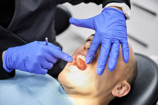 Best Knocked-Out Tooth (Avulsed Tooth) Treatment in La Vernia, TX